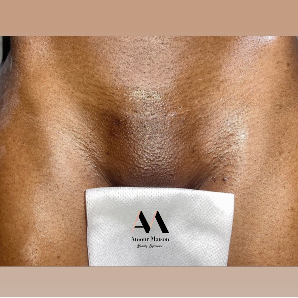 Bikini Waxing_Near me_28907 Evergreen Rd, Southfield, MI 48076, United States_Amour Maison Beauty Experience 1