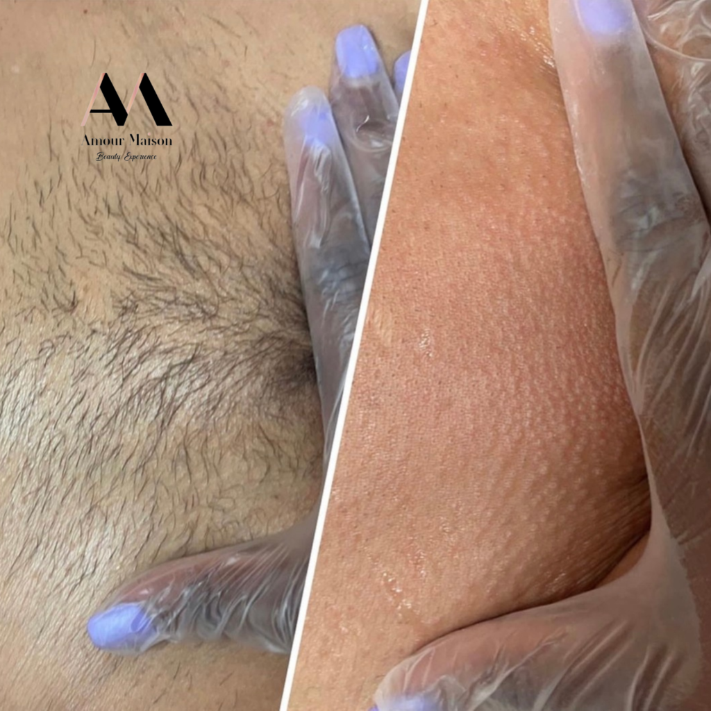 Brazilian Wax_Near me_28907 Evergreen Rd, Southfield, MI 48076, United States_Amour Maison Beauty Experience 1.png