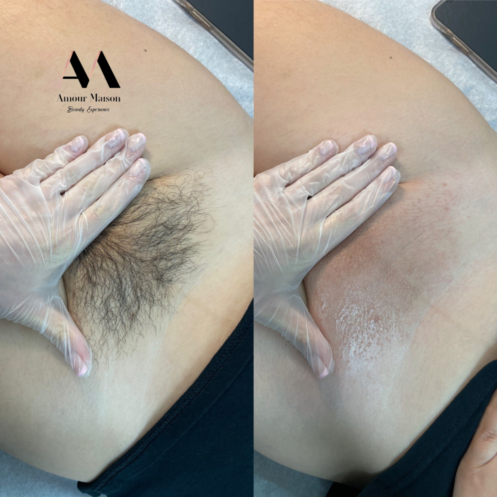 Brazilian Wax_Near me_28907 Evergreen Rd, Southfield, MI 48076, United States_Amour Maison Beauty Experience 1